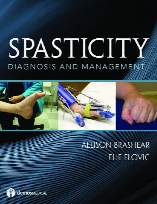 Spasticity Diagnosis And Management. | Physiolair | All You Need About ...