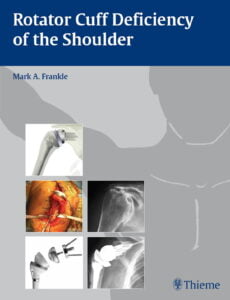 rotator cuff deficiency of the shoulder