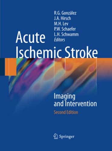 Acute Ischemic Stroke Imaging And Intervention Second Edition ...