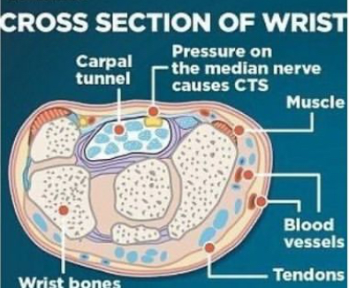 腕管綜合徵的解剖