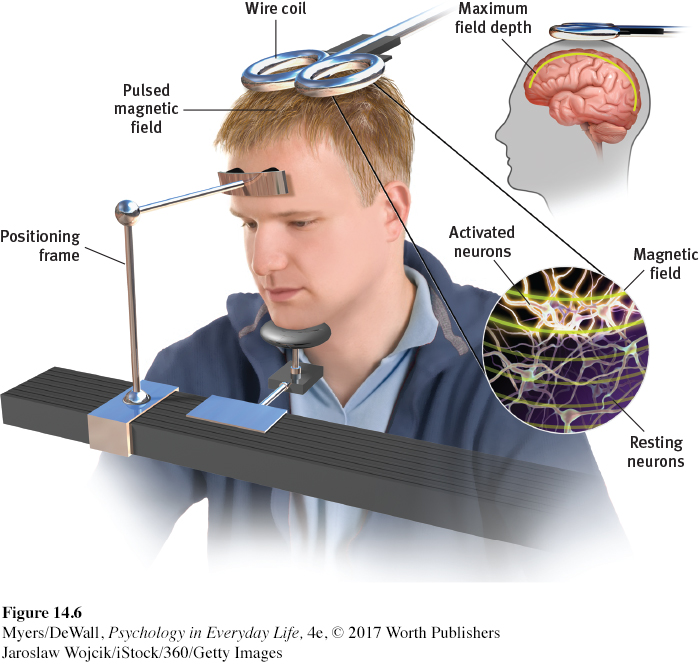 low-frequency repetitive transcranial magnetic stimulation 