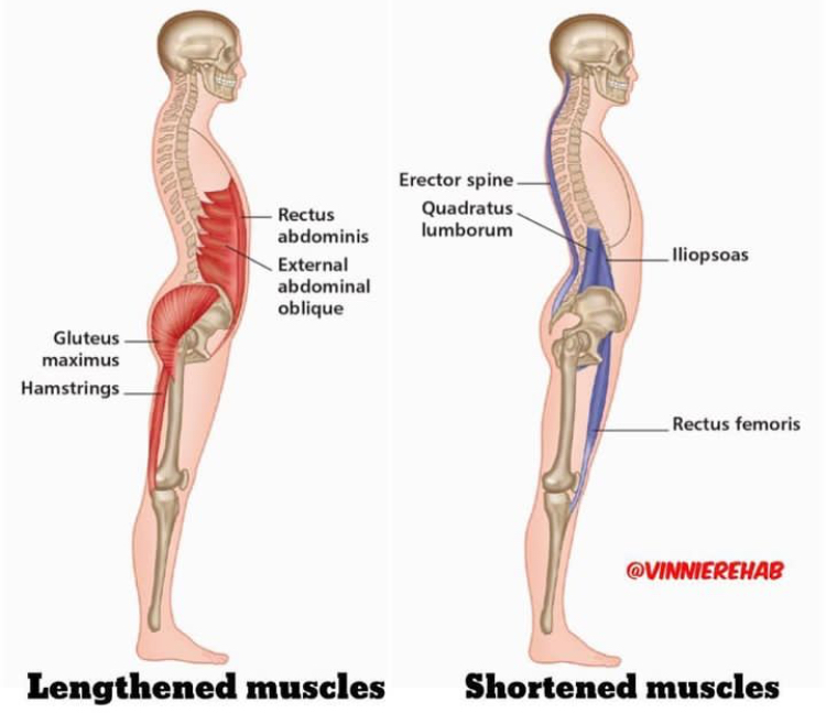 Relationship between Muscle Imbalance (anterior and posterior thigh muscles) and pelvic Tilt.